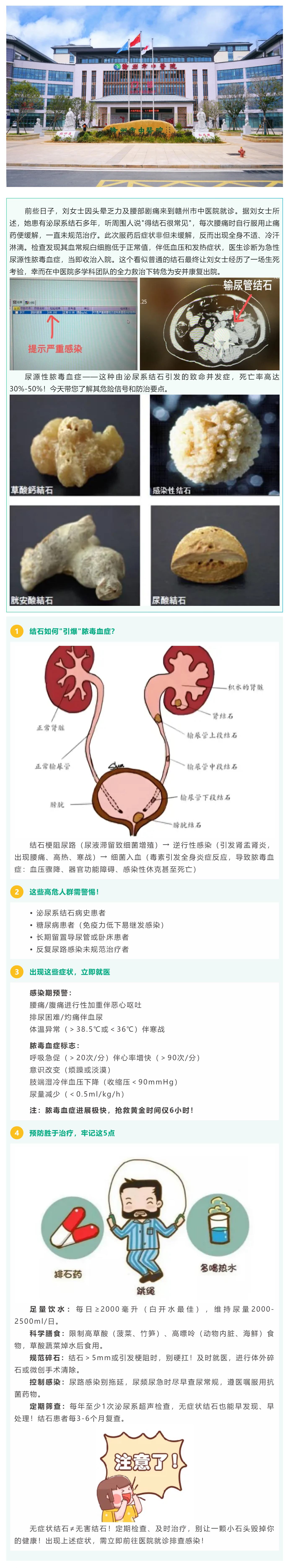 沉默的结石，暗藏的_致命危机_——警惕尿源性脓毒血症！.png