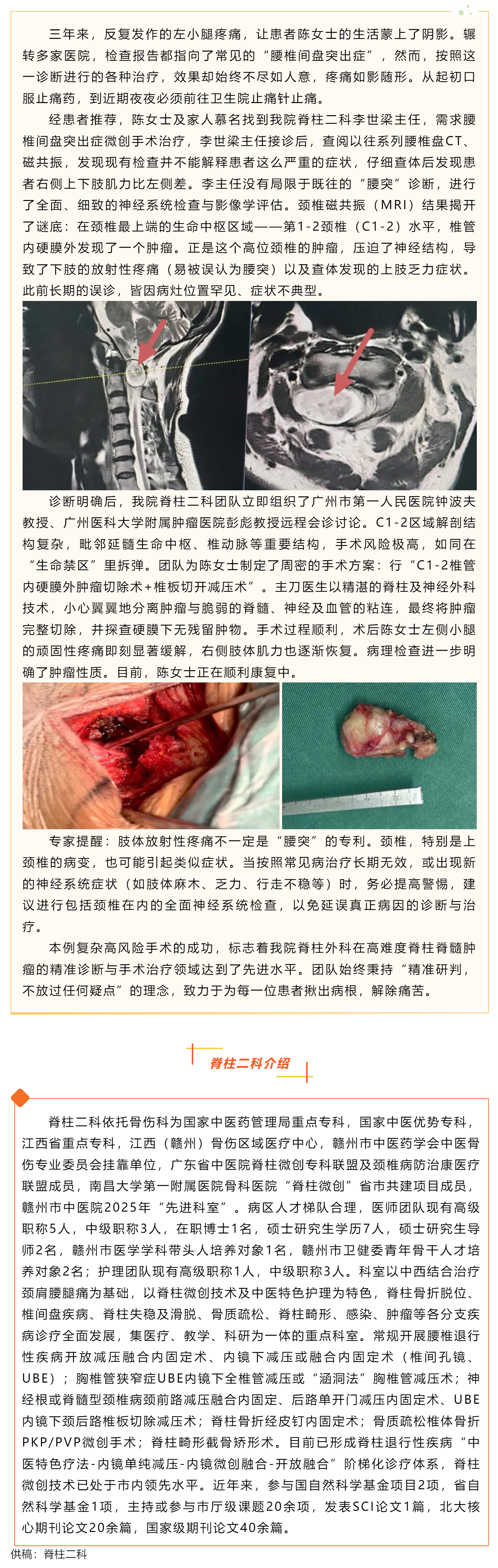 告别三年误诊之痛，精准手术解除&ldquo;颈椎定时炸弹&rdquo;&mdash;&mdash;我院脊柱二科成功诊治一例C1-2椎管内硬膜外肿瘤.png