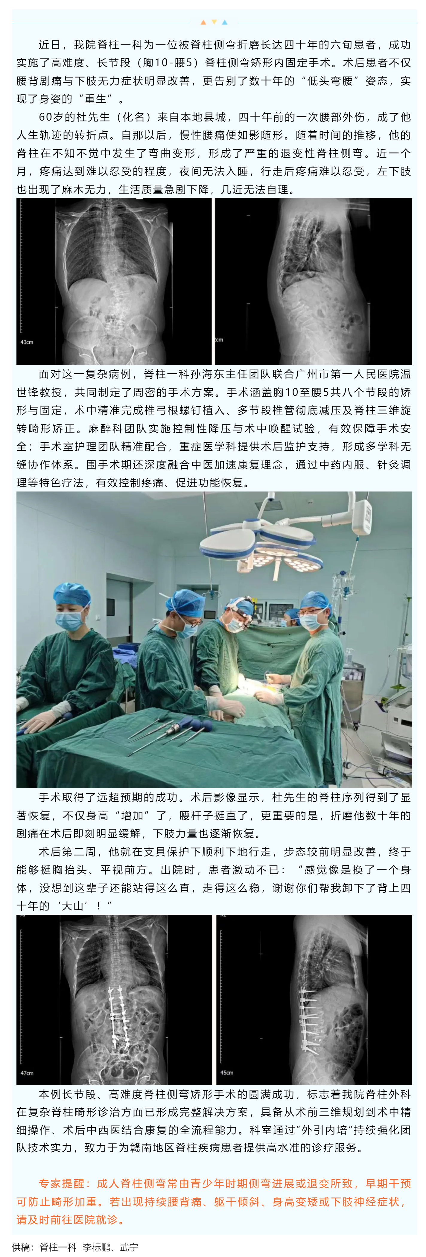 低头生活四十年，一朝手术挺脊梁&mdash;&mdash;我院脊柱一科成功完成高难度长节段脊柱侧弯矫形手术.png