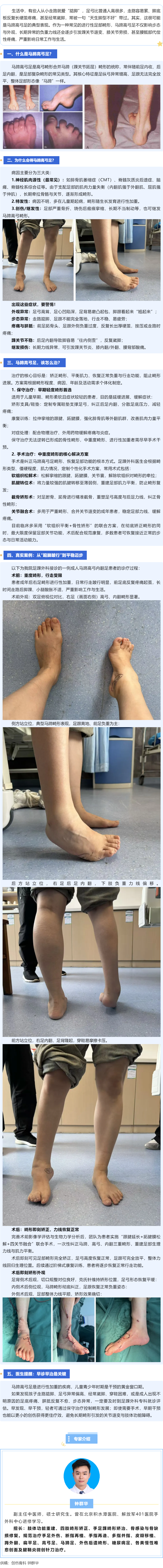 马蹄高弓足&ne;&ldquo;天生脚型不好&rdquo; _ 矫形手术帮你放平双脚，走稳人生路.png